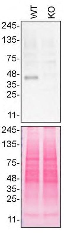 Invitrogen TMEM106B Polyclonal Antibody 100 &mu;L | Buy Online | Invitrogen&trade; | Fisher Scientific