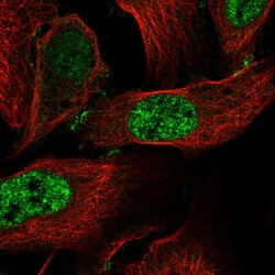 Invitrogen CCDC85C Polyclonal Antibody 100 &mu;L; Unconjugated:Antibodies,