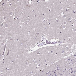 Invitrogen CCDC85C Polyclonal Antibody 100 &mu;L; Unconjugated:Antibodies,