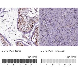 Invitrogen SETD1A Polyclonal Antibody 100 &mu;L; Unconjugated:Antibodies,