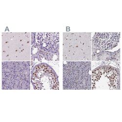 Invitrogen SETD1A Polyclonal Antibody 100 &mu;L; Unconjugated:Antibodies,