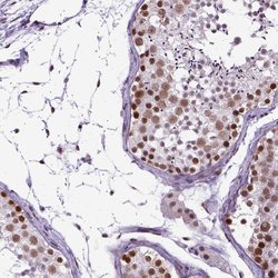 Invitrogen SETD1A Polyclonal Antibody 100 &mu;L; Unconjugated:Antibodies,