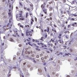 Invitrogen SETD1A Polyclonal Antibody 100 &mu;L; Unconjugated:Antibodies,