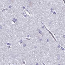 Invitrogen SNTN Polyclonal Antibody 100 &mu;L; Unconjugated:Antibodies,