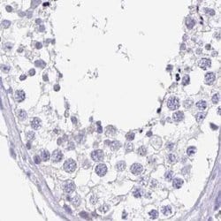 Invitrogen SNTN Polyclonal Antibody 100 &mu;L; Unconjugated:Antibodies,