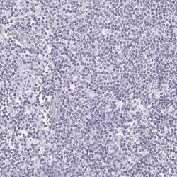 Invitrogen FXYD4 Polyclonal Antibody 100 &mu;L; Unconjugated:Antibodies,