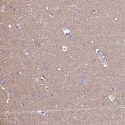 Invitrogen LIX1 Polyclonal Antibody 100 &mu;L; Unconjugated:Antibodies,