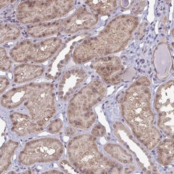 Invitrogen LIX1 Polyclonal Antibody 100 &mu;L; Unconjugated:Antibodies,