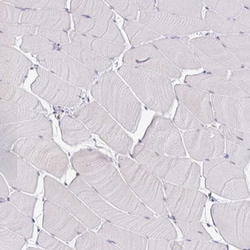 Invitrogen LIX1 Polyclonal Antibody 100 &mu;L; Unconjugated:Antibodies,