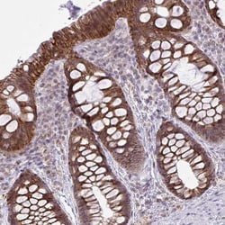 Invitrogen CYP20A1 Polyclonal Antibody 100 &mu;L; Unconjugated:Antibodies,