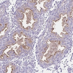 Invitrogen SEMA6B Polyclonal Antibody 100 &mu;L; Unconjugated:Antibodies,