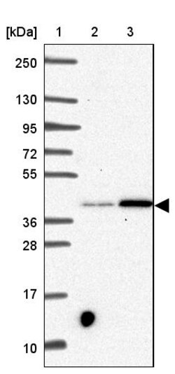 Invitrogen SLC39A3 Polyclonal Antibody 100 &mu;L | Buy Online | Invitrogen&trade; | Fisher Scientific