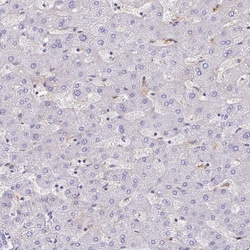 Invitrogen™ GRID2 Polyclonal Antibody