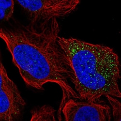 Invitrogen Cytochrome B5 Polyclonal Antibody 100 &mu;L; Unconjugated:Antibodies,