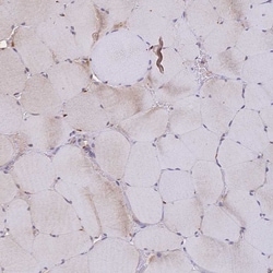 Invitrogen Cytochrome B5 Polyclonal Antibody 100 &mu;L; Unconjugated:Antibodies,