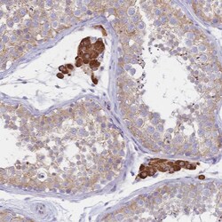 Invitrogen Cytochrome B5 Polyclonal Antibody 100 &mu;L; Unconjugated:Antibodies,