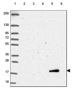 Invitrogen Cytochrome B5 Polyclonal Antibody 100 &mu;L; Unconjugated:Antibodies,