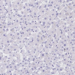 Invitrogen Bestrophin 4 Polyclonal Antibody 100 &mu;L; Unconjugated:Antibodies,