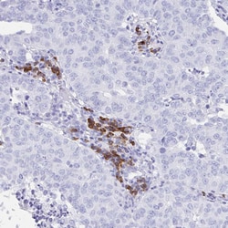 Invitrogen Bestrophin 4 Polyclonal Antibody 100 &mu;L; Unconjugated:Antibodies,