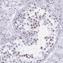 Invitrogen CCDC105 Polyclonal Antibody 100 &mu;L; Unconjugated:Antibodies,