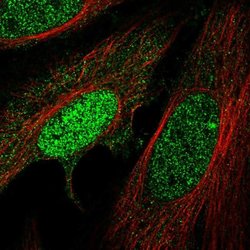 Invitrogen HMBOX1 Polyclonal Antibody 100 &mu;L; Unconjugated:Antibodies,