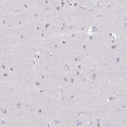 Invitrogen ELF4 Polyclonal Antibody 100 &mu;L; Unconjugated:Antibodies,