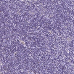 Invitrogen NGB Polyclonal Antibody 100 &mu;L; Unconjugated:Antibodies,