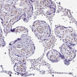 Invitrogen NGB Polyclonal Antibody 100 &mu;L; Unconjugated:Antibodies,