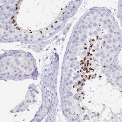 Invitrogen ZPBP Polyclonal Antibody 100 &mu;L; Unconjugated:Antibodies,