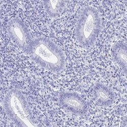 Invitrogen ZPBP Polyclonal Antibody 100 &mu;L; Unconjugated:Antibodies,