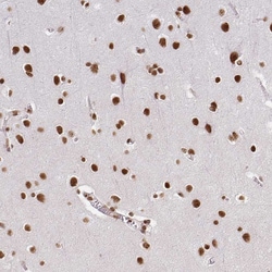 Invitrogen hnRNP U Polyclonal Antibody 100 &mu;L; Unconjugated:Antibodies,