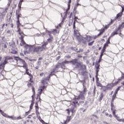 Invitrogen KRT82 Polyclonal Antibody 100 &mu;L; Unconjugated:Antibodies,