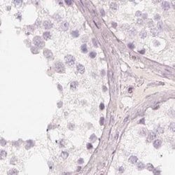 Invitrogen KRT82 Polyclonal Antibody 100 &mu;L; Unconjugated:Antibodies,