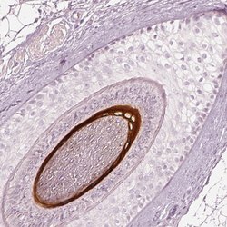 Invitrogen KRT82 Polyclonal Antibody 100 &mu;L; Unconjugated:Antibodies,