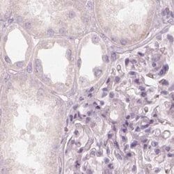 Invitrogen KRT82 Polyclonal Antibody 100 &mu;L; Unconjugated:Antibodies,