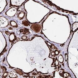 Invitrogen ORP5 Polyclonal Antibody 100 &mu;L; Unconjugated:Antibodies,
