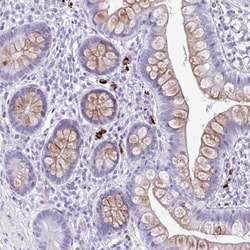 Invitrogen C12orf71 Polyclonal Antibody 100 &mu;L; Unconjugated:Antibodies,