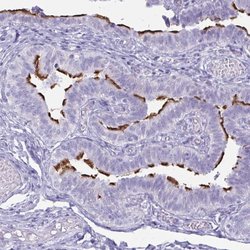 Invitrogen BBS10 Polyclonal Antibody 100 &mu;L; Unconjugated:Antibodies,