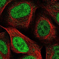 Invitrogen PPM1H Polyclonal Antibody 100 &mu;L; Unconjugated:Antibodies,
