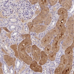 Invitrogen ANO5 Polyclonal Antibody 100 &mu;L; Unconjugated:Antibodies,