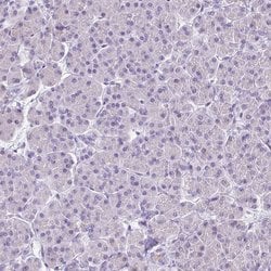 Invitrogen VGAT Polyclonal Antibody 100 &mu;L; Unconjugated:Antibodies,