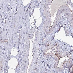Invitrogen OR1L3 Polyclonal Antibody 100 &mu;L; Unconjugated:Antibodies,