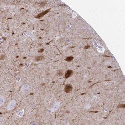 Invitrogen OR4M2 Polyclonal Antibody 100 &mu;L; Unconjugated:Antibodies,