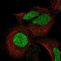 Invitrogen ADAT3 Polyclonal Antibody 100 &mu;L; Unconjugated:Antibodies,