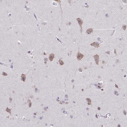Invitrogen ADAT3 Polyclonal Antibody 100 &mu;L; Unconjugated:Antibodies,