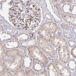 Invitrogen PALM2-AKAP2 Polyclonal Antibody 100 &mu;L; Unconjugated:Antibodies,