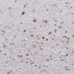 Invitrogen QDPR Polyclonal Antibody 100 &mu;L; Unconjugated:Antibodies,