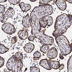 Invitrogen ATAD3B Polyclonal Antibody 100 &mu;L; Unconjugated:Antibodies,