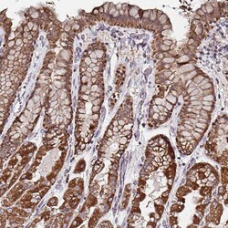 Invitrogen ATAD3B Polyclonal Antibody 100 &mu;L; Unconjugated:Antibodies,