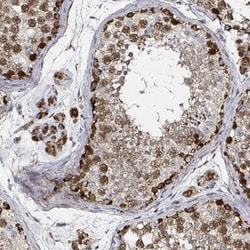 Invitrogen ATAD3B Polyclonal Antibody 100 &mu;L; Unconjugated:Antibodies,